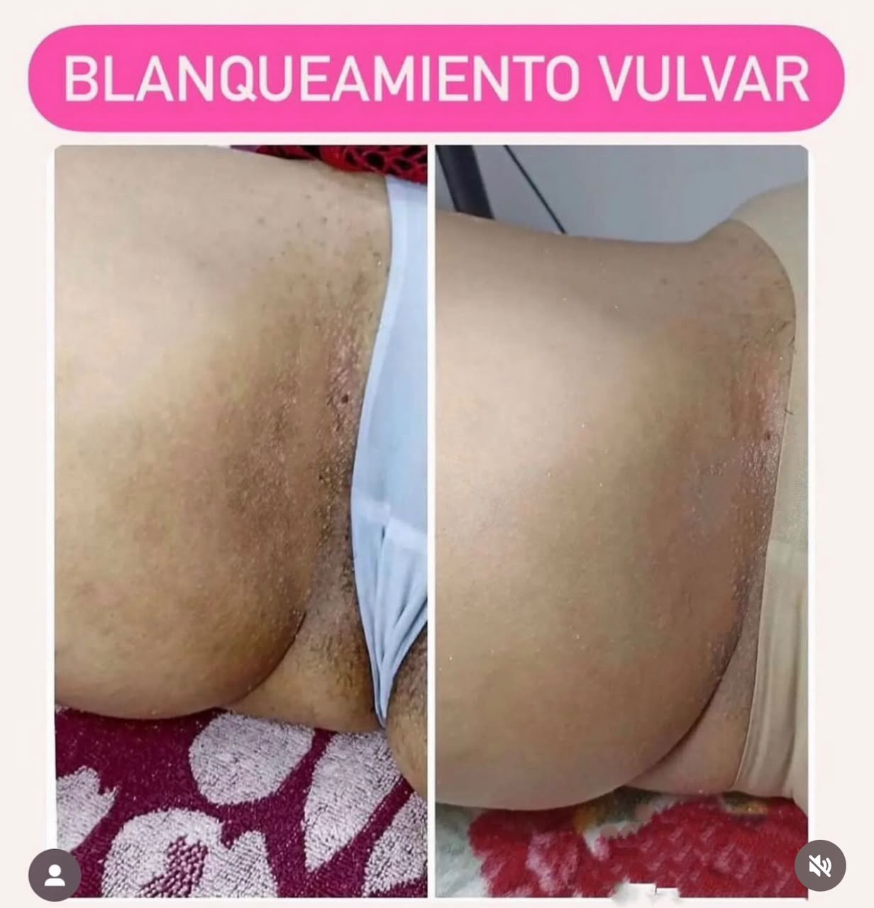 Testimonio 6