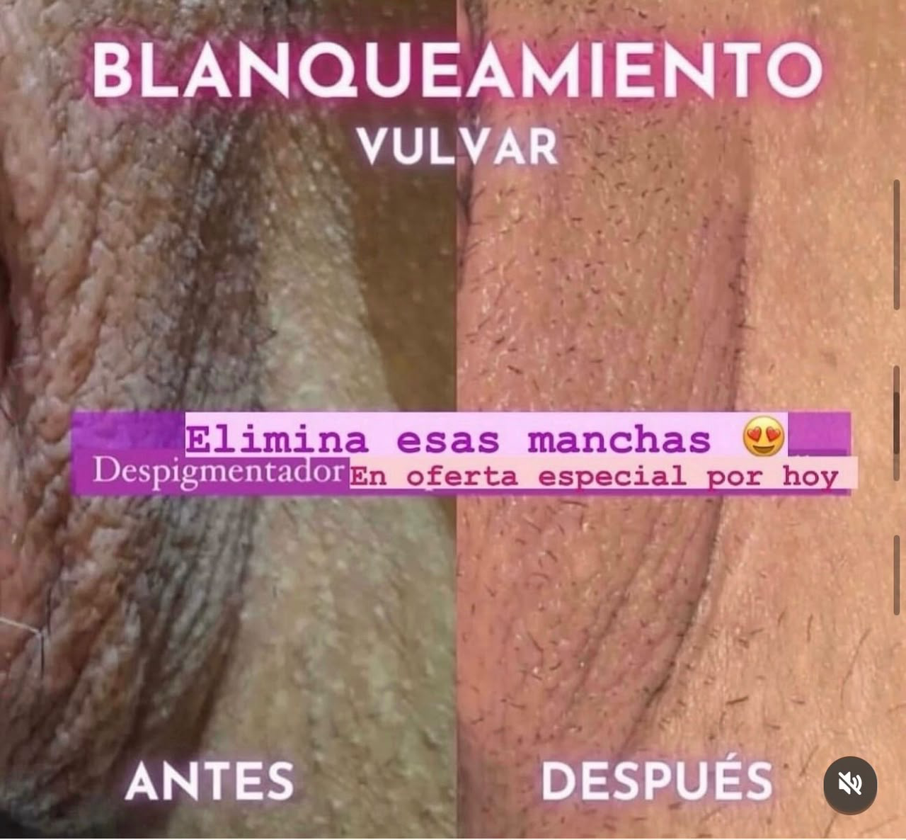 Testimonio 7